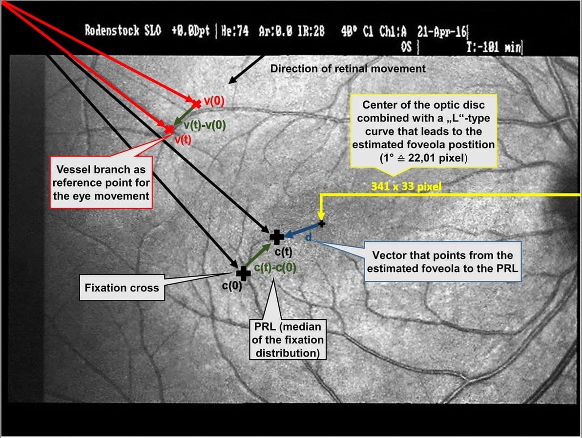 EyeOnVision January, 2022