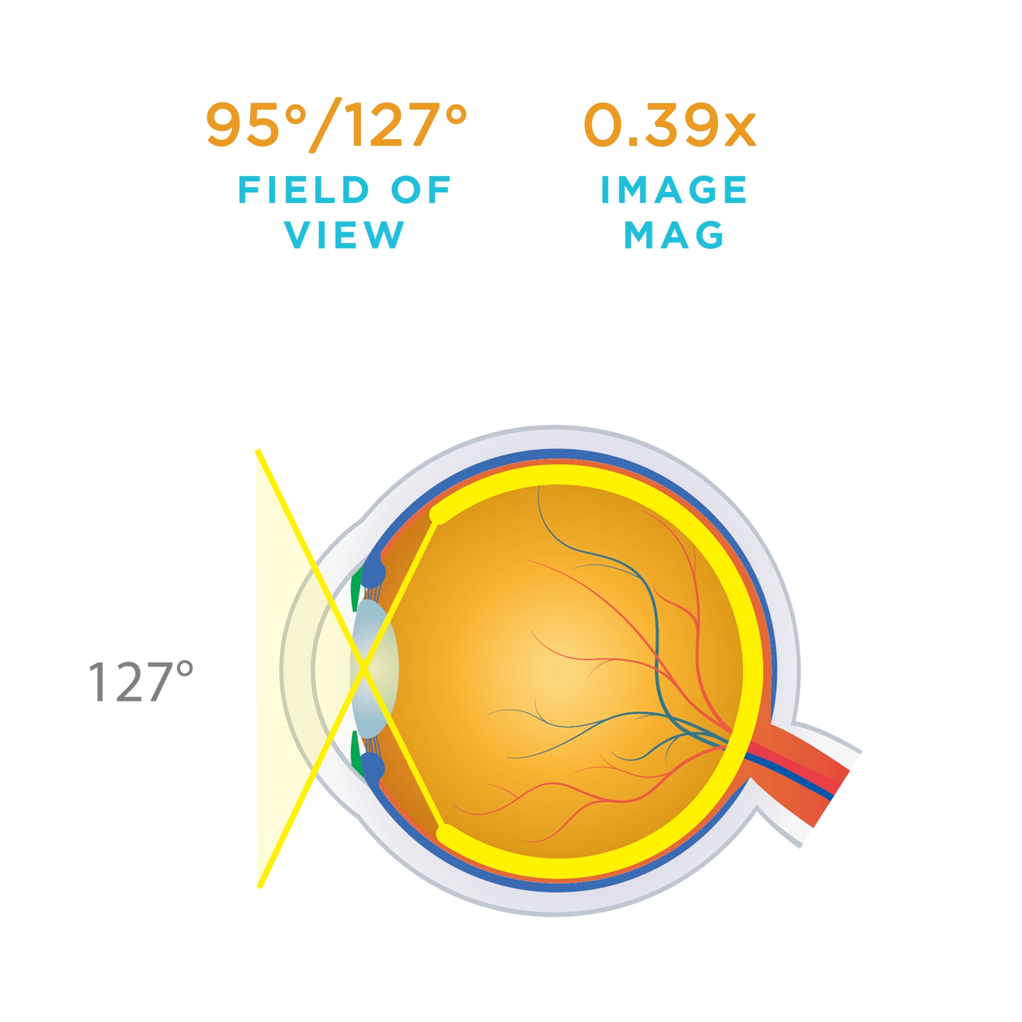 DynaView — manufacturer image