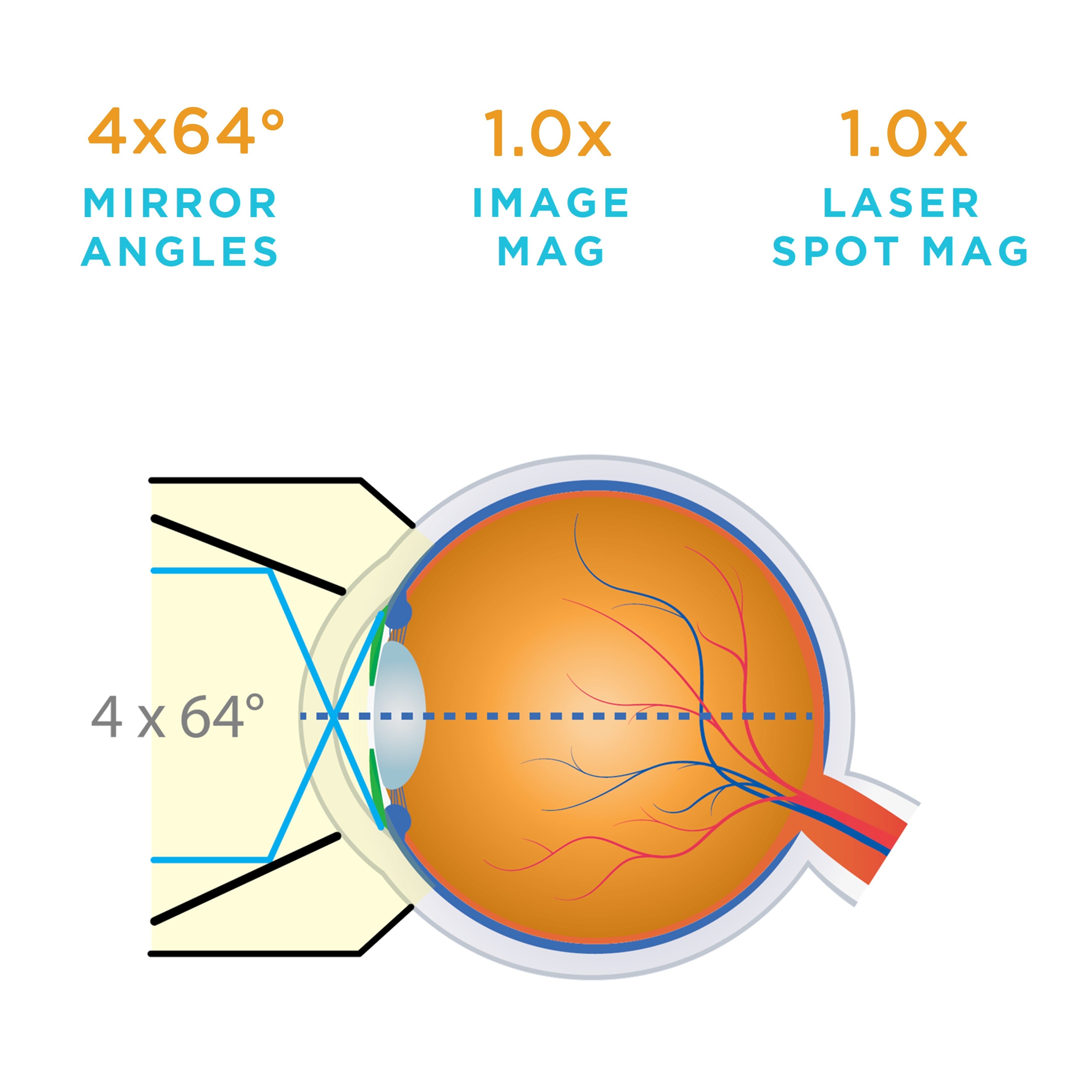G-4 Gonio, No Flange, Large Ring — manufacturer image