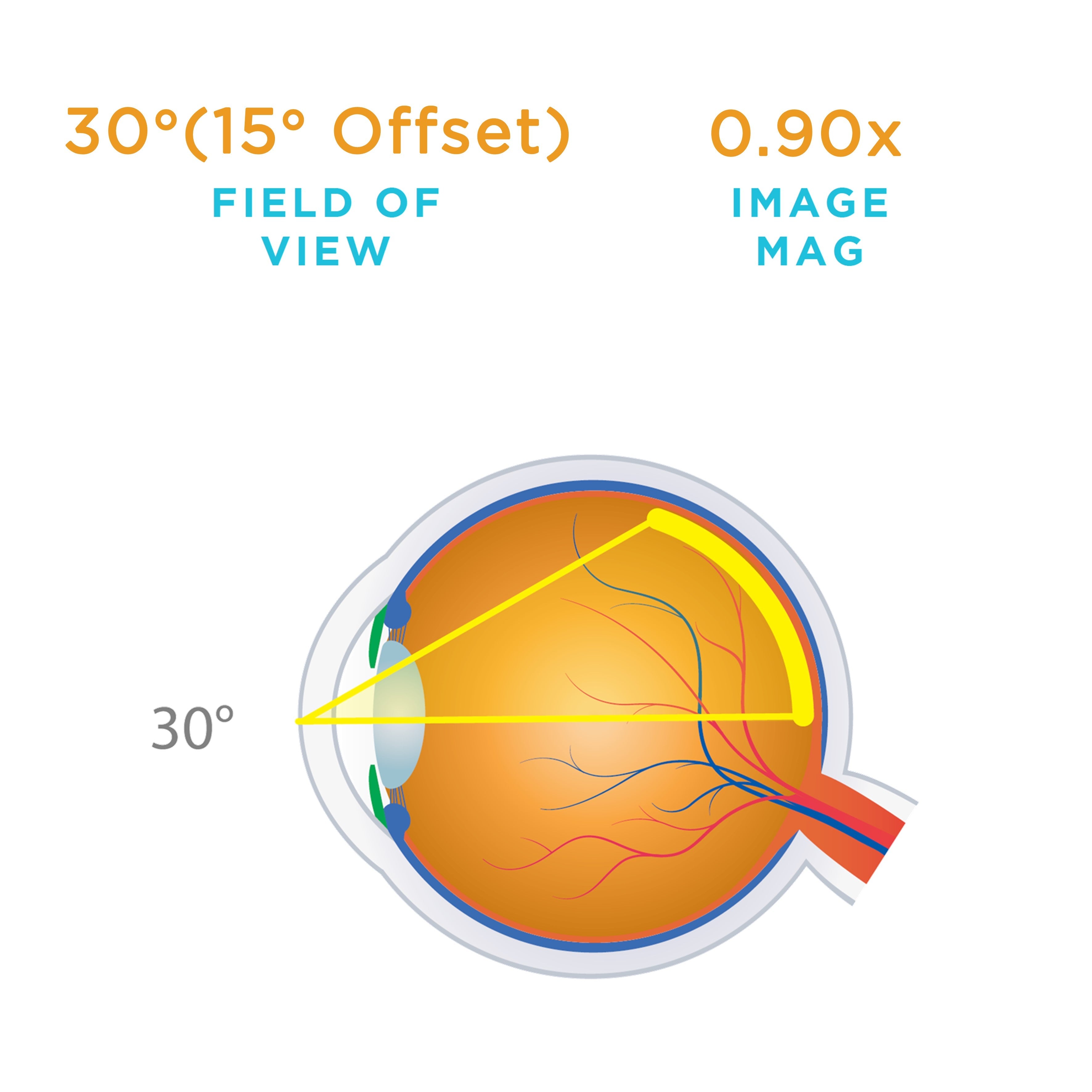 Chalam 45° Prism SSV® (ACS®) — manufacturer image