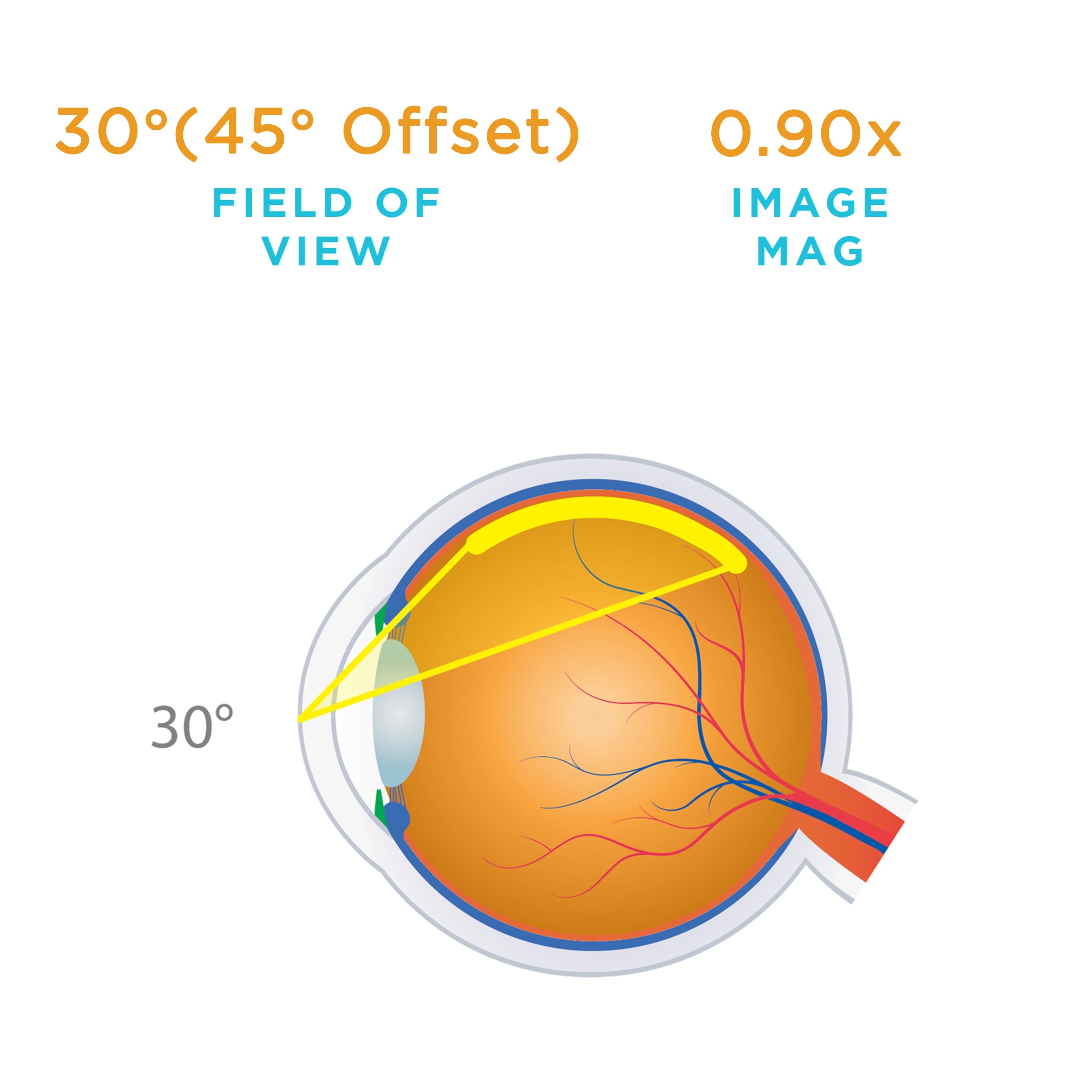 Chalam 15° Prism SSV® (ACS®) — manufacturer image