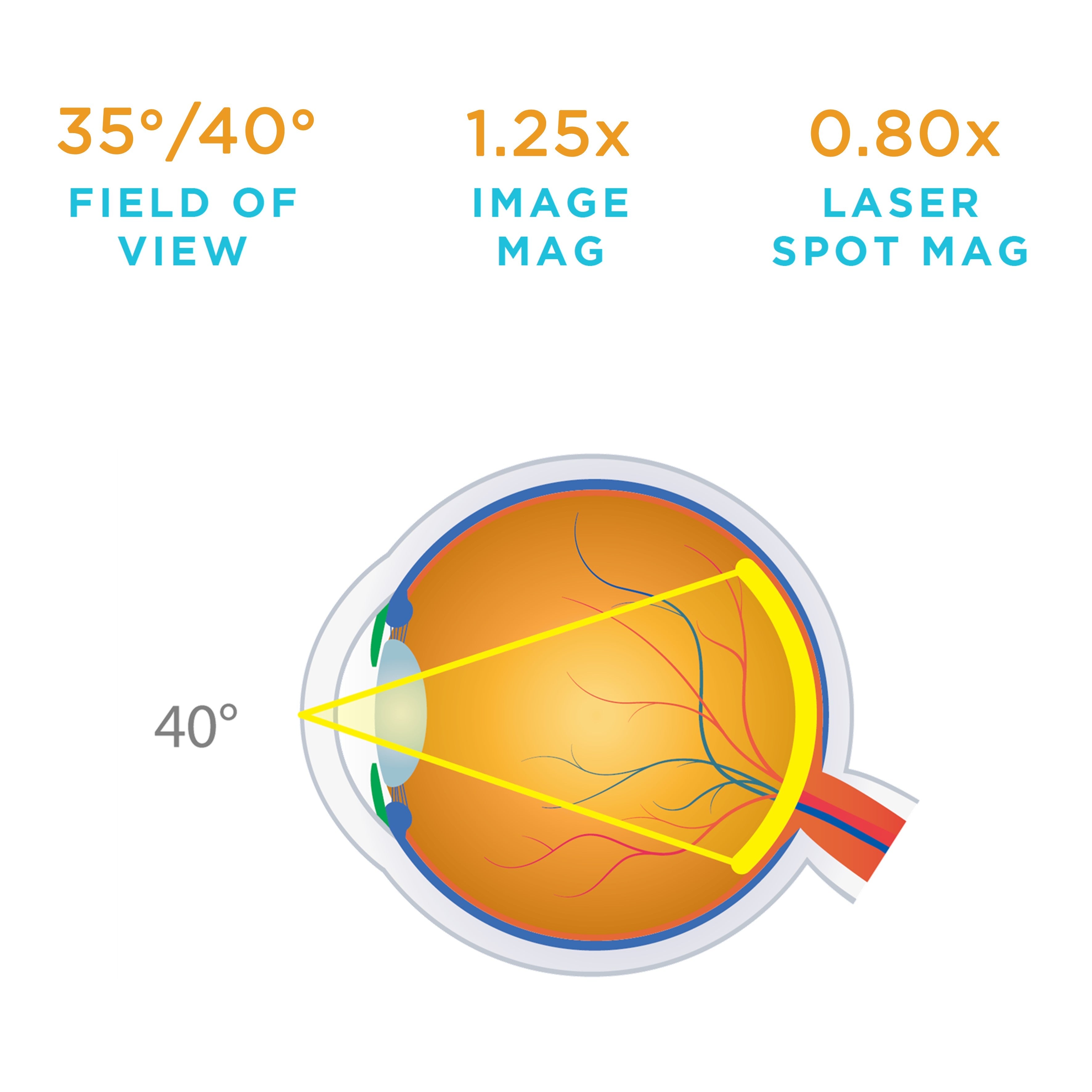 Fundus Laser 20MM — manufacturer image