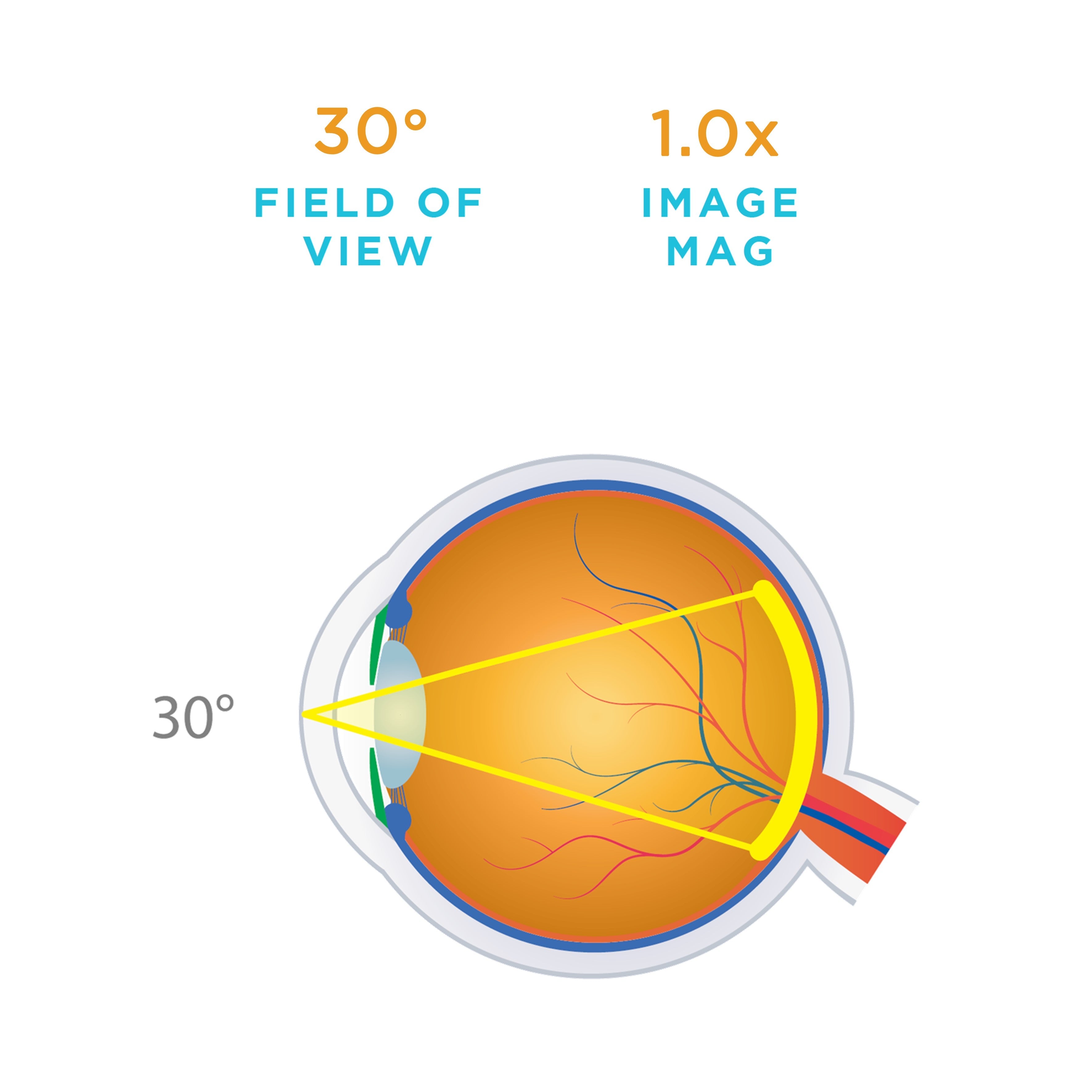 HR Direct 1X, NSR (No Stabilizing Ring) — manufacturer image