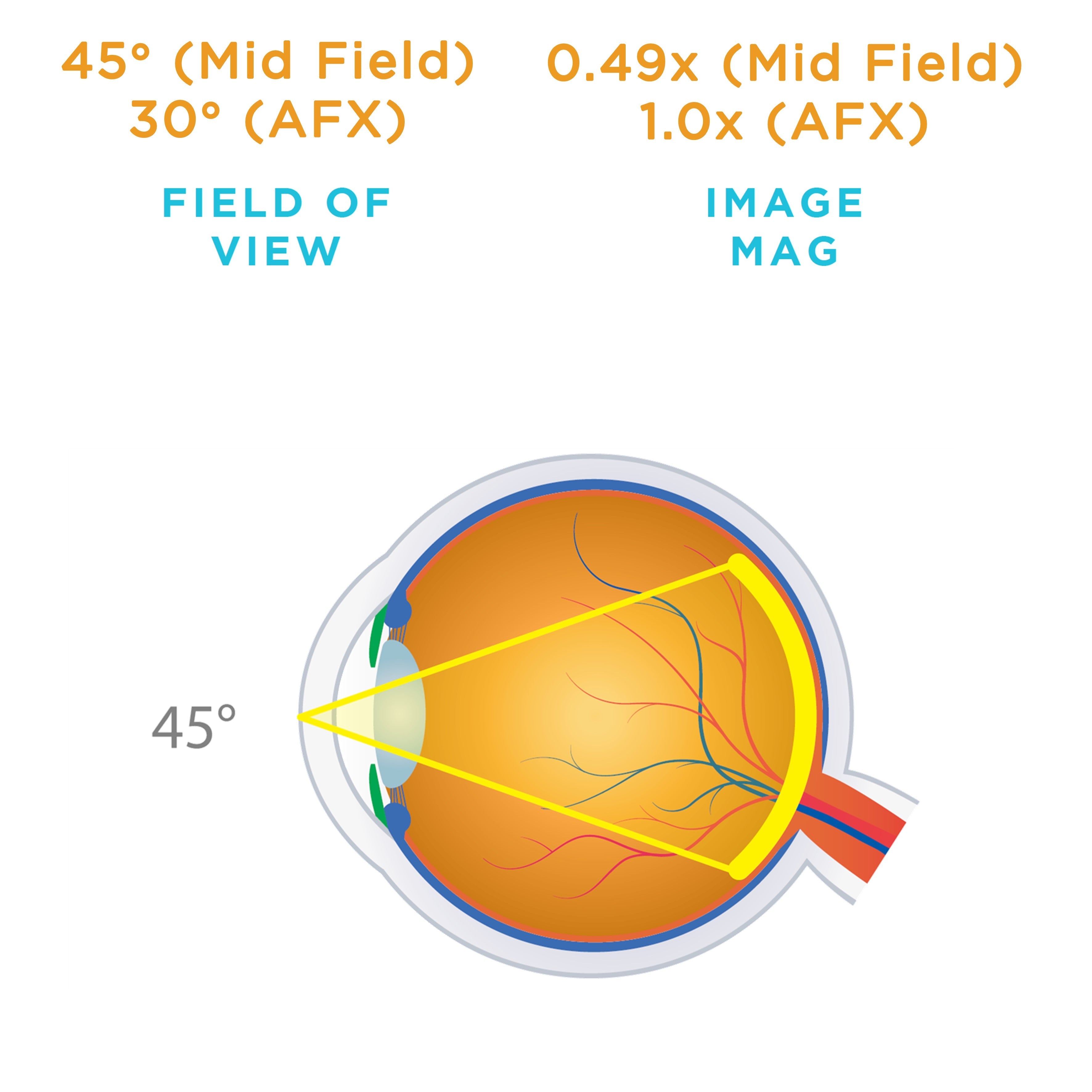 HR Direct Bi-Concave — manufacturer image