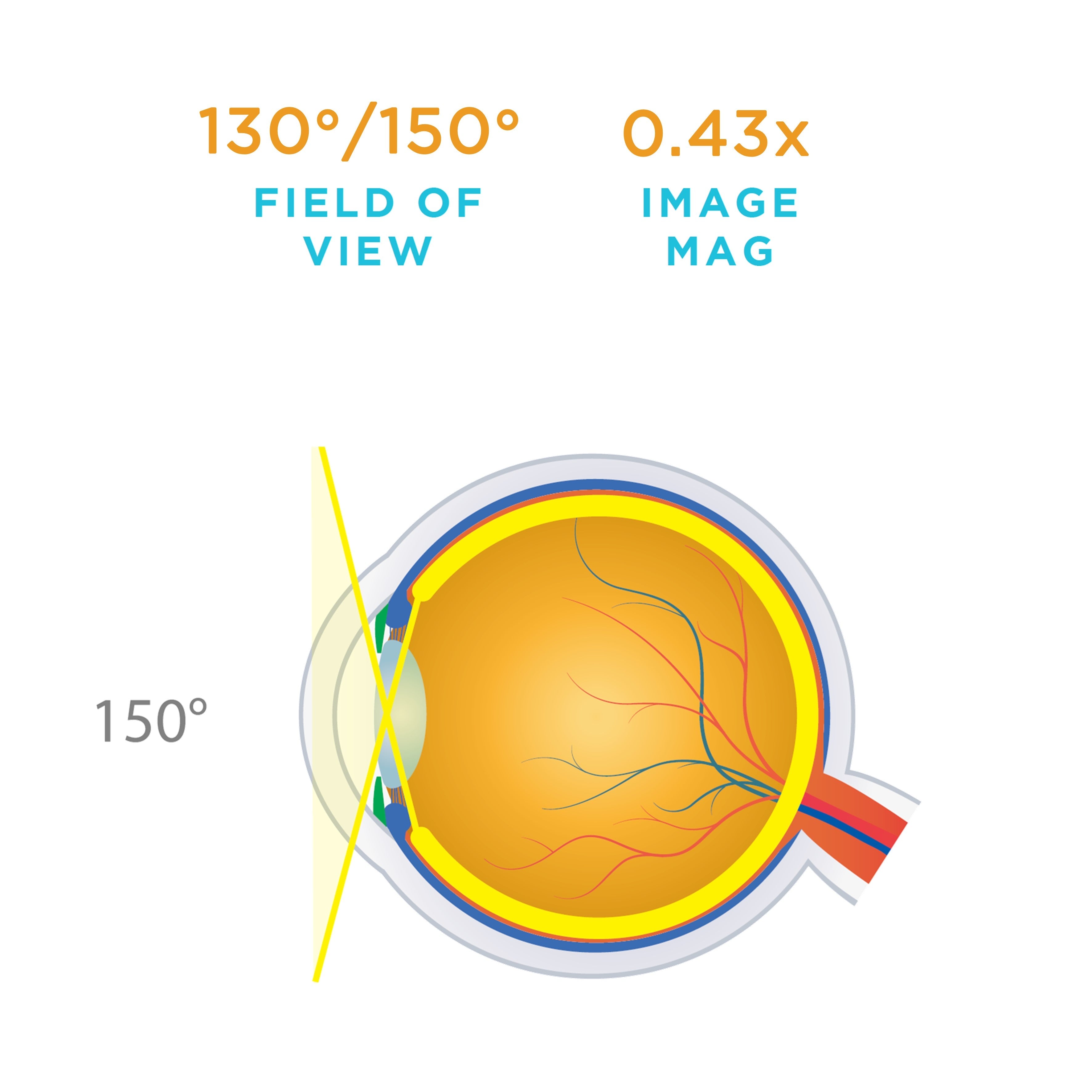 HRX ACS® — manufacturer image