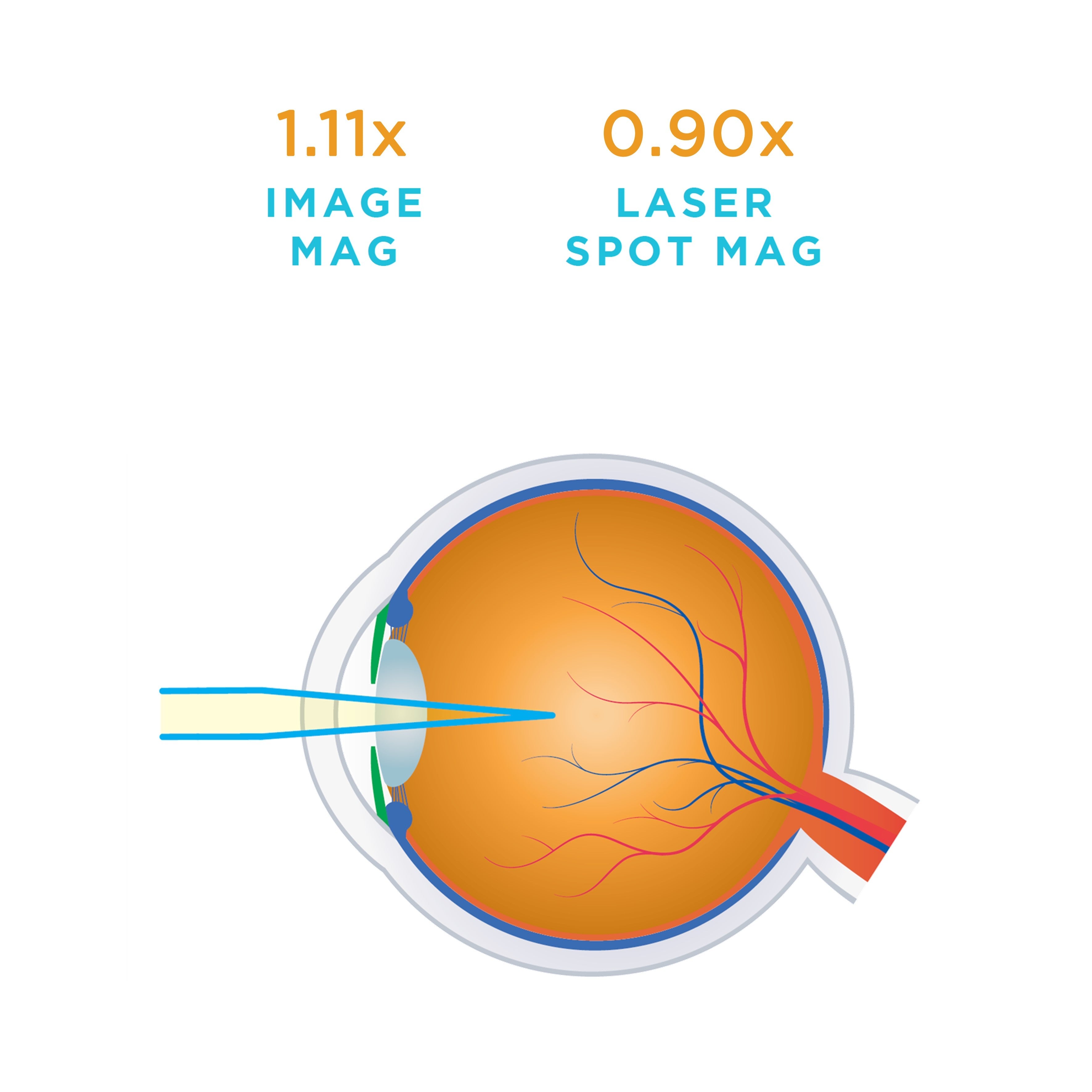 Idrees MidVitreous — manufacturer image