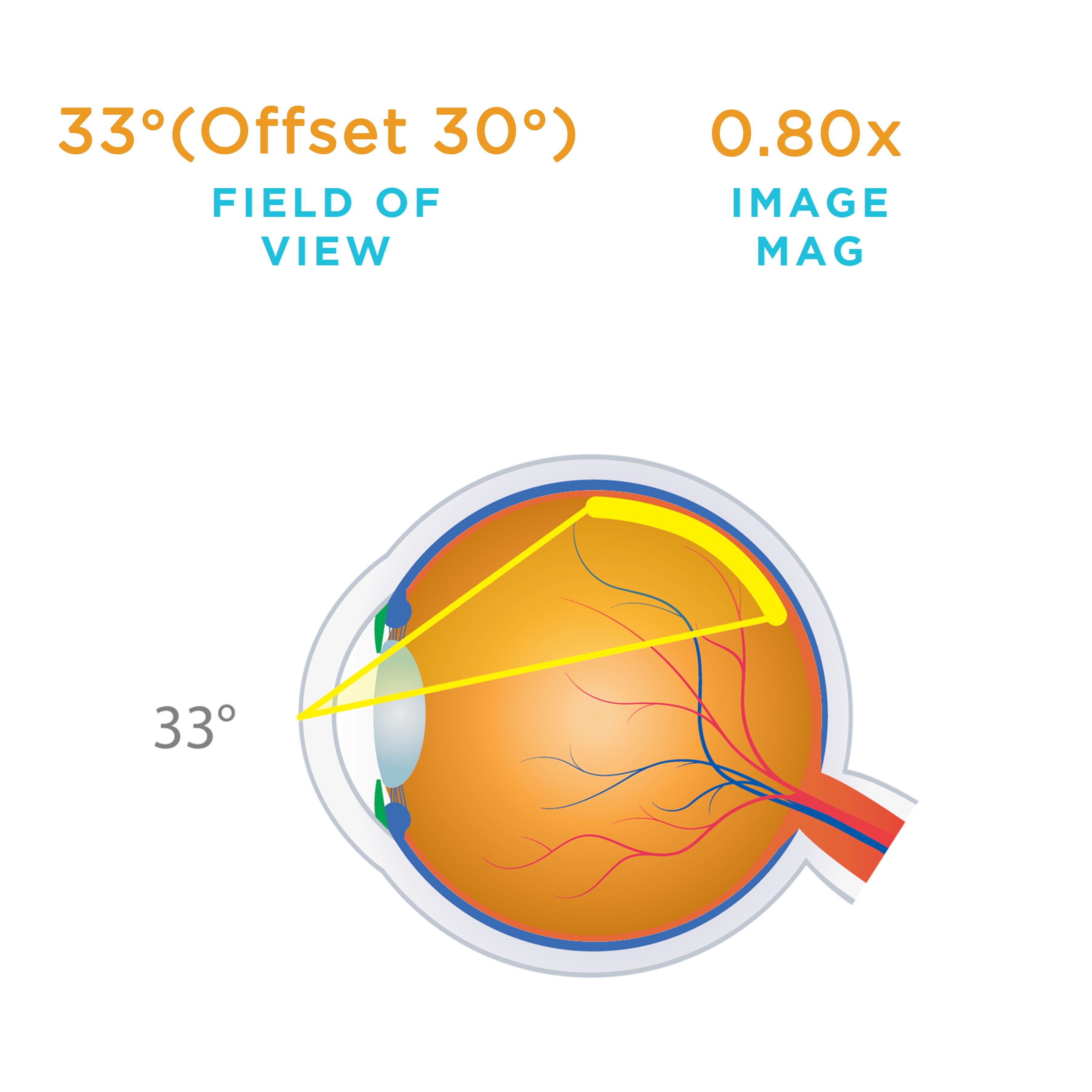 Volk®1 Single-Use 30° Prism